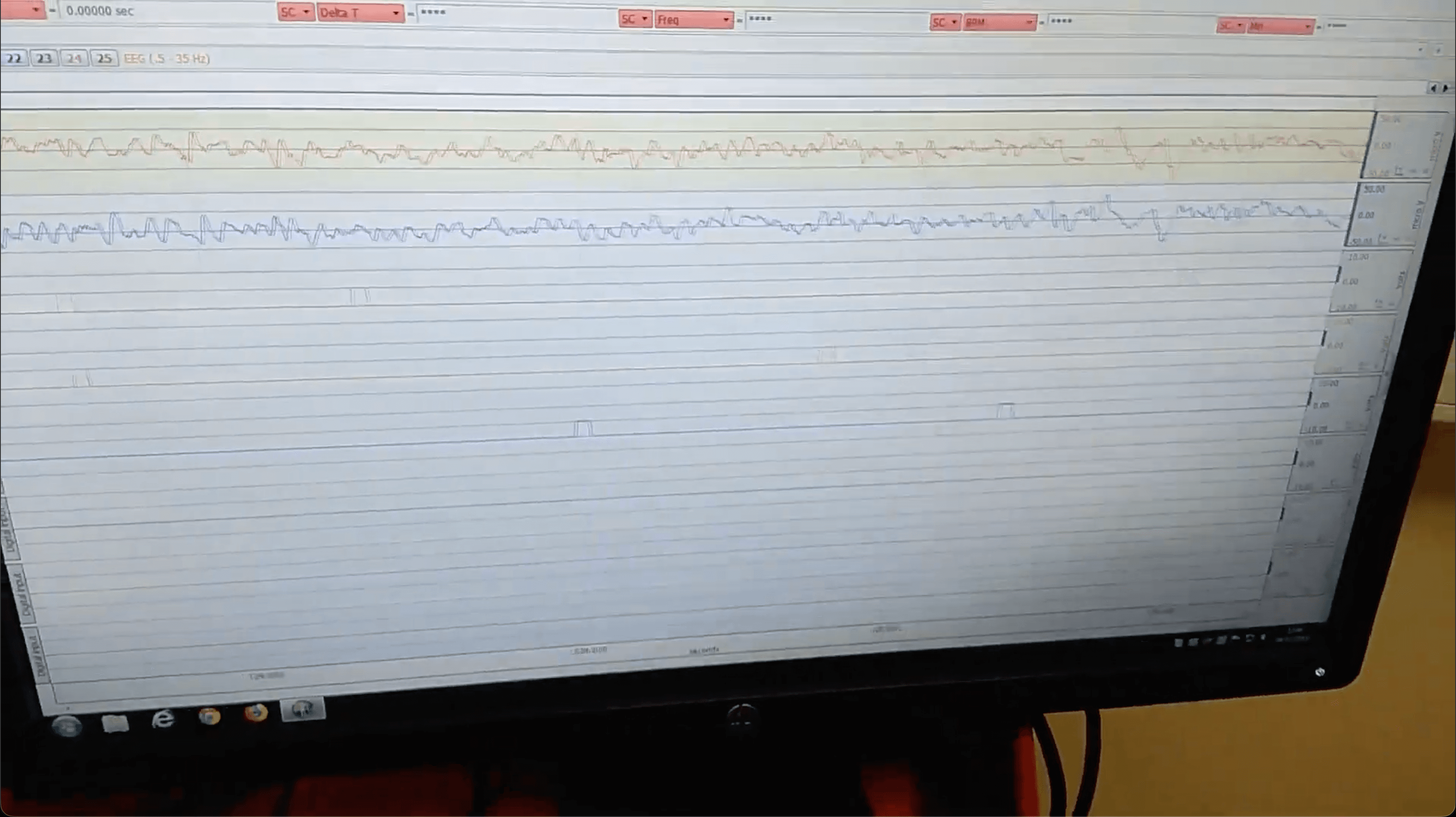 Close-up of live EEG traces and task event markers on the recording monitor